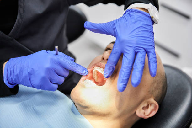 Best Chipped Tooth Repair Near Me  in Weldon Spring, MO